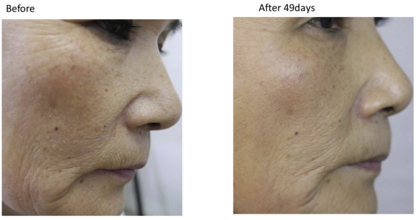 Carboxy Mousse Moisturizer - The Curated Skin Studio