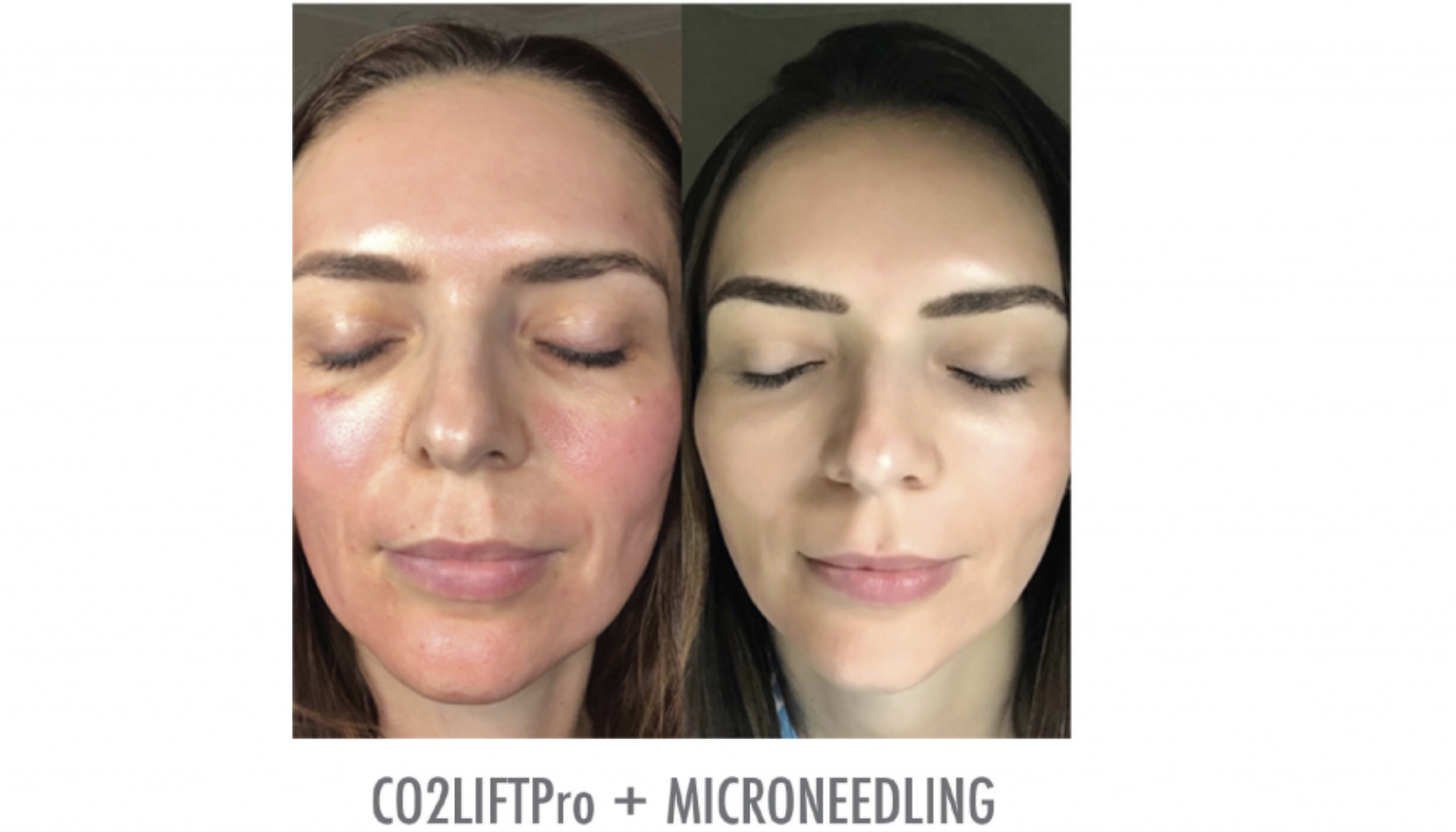 CO2 Lift Pro Mask - The Curated Skin Studio